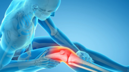 knee replacement surgery in Delhi