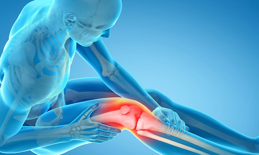 knee replacement surgery in Delhi