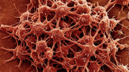 Thromboxane A2 ELISA Kit