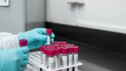 serum amyloid A ELISA kit