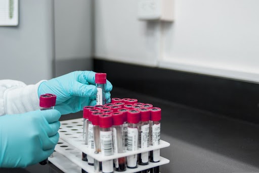 serum amyloid A ELISA kit