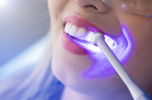 professional smile whitening solutions in Colorado Springs